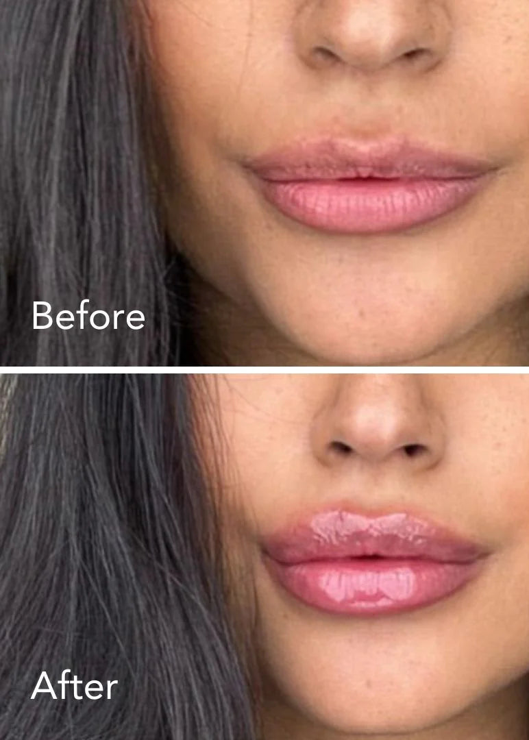 Veyorta Juicy Kiss Plumper